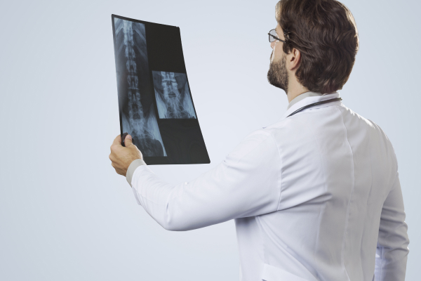 A doctor is holding up and examining an X-ray of the cervical spine.