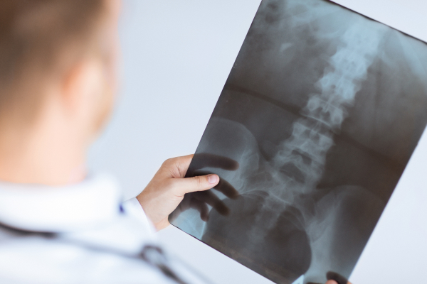A spine expert analyzes an x-ray image of the spine.