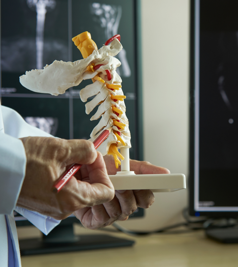 A physician is holding and pointing to a model of the cervical spine illustrating anterior cervical discectomy and fusion treatment for pain relief.