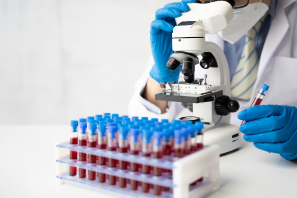 A lab technician analyzes the blood samples with a microscope.