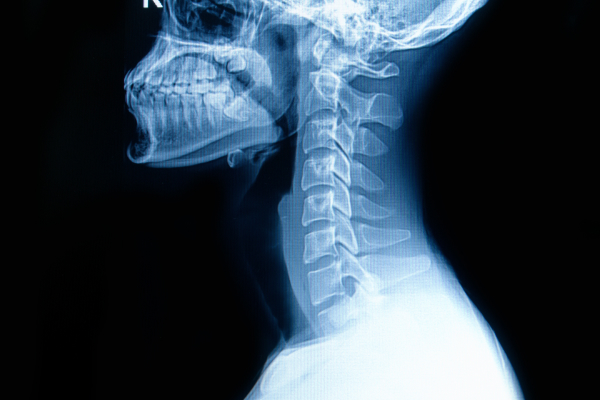 An X-ray image of the neck.