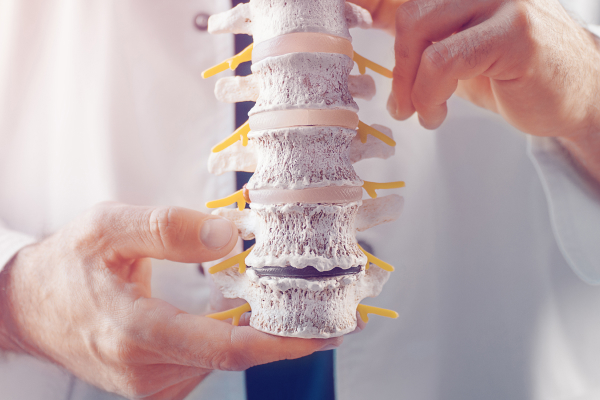 A spine expert holding a spine model.