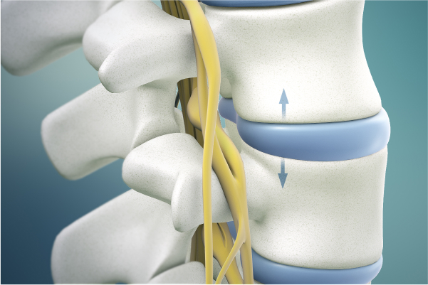 A close-up shot of the arrangement of the spine discs for spine decompression.